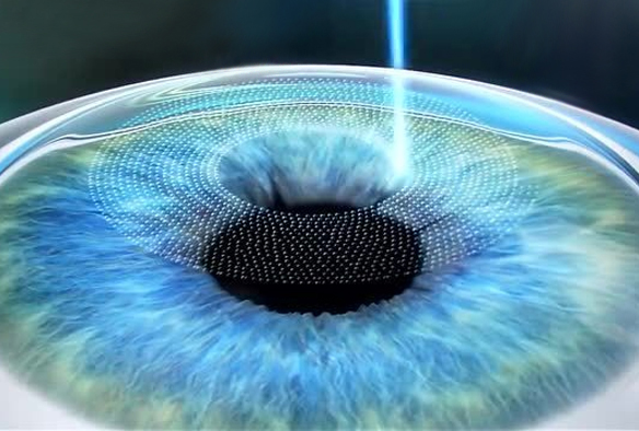 某上市医疗集团眼科医院—O2BOX高压氧舱案例展示-高压氧舱,O2BOX高压氧舱官网,高压氧舱多少钱一台